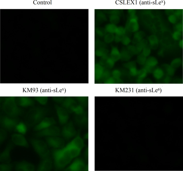 A Atractylodes lancea polysaccharide inhibits metastasis of human osteosarcoma U-2 OS cells by blocking sialyl Lewis X (sLe<sup>x</sup> )/E-selectin binding.