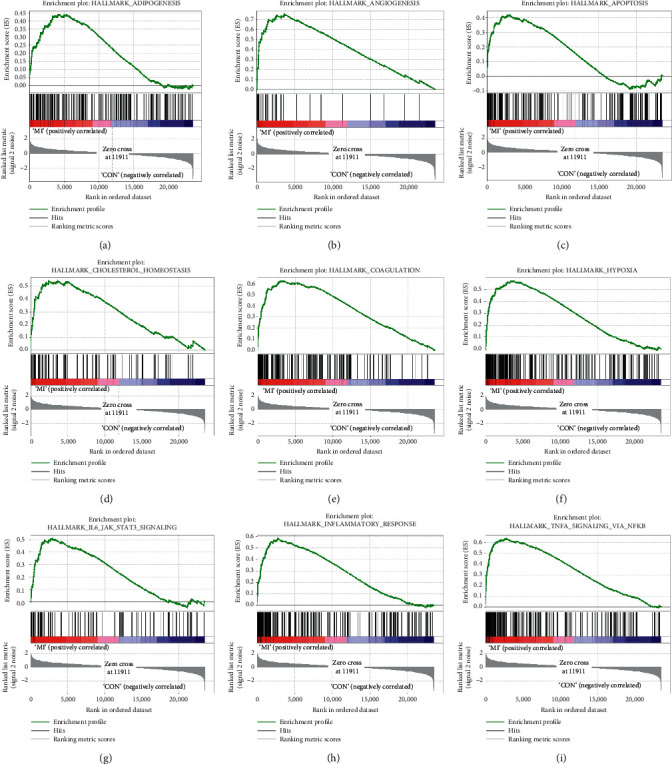 Bioinformatics Analysis Reveals Diagnostic Markers and Vital Pathways Involved in Acute Coronary Syndrome.