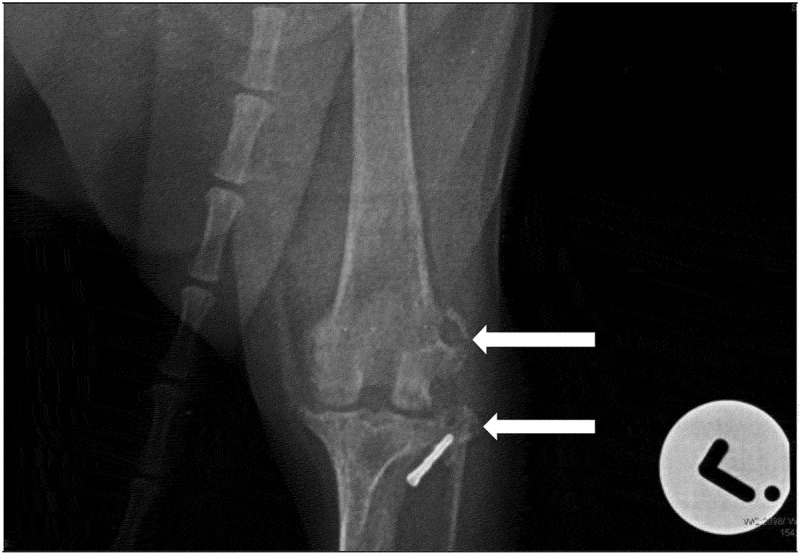Chronic lymphoplasmacytic villonodular proliferative synovitis in a 10-year-old Jack Russell Terrier dog.