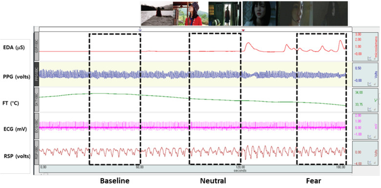 Predicting Individuals' Experienced Fear From Multimodal Physiological Responses to a Fear-Inducing Stimulus.