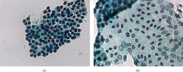 Radial Basis Function Artificial Neural Network for the Investigation of Thyroid Cytological Lesions.