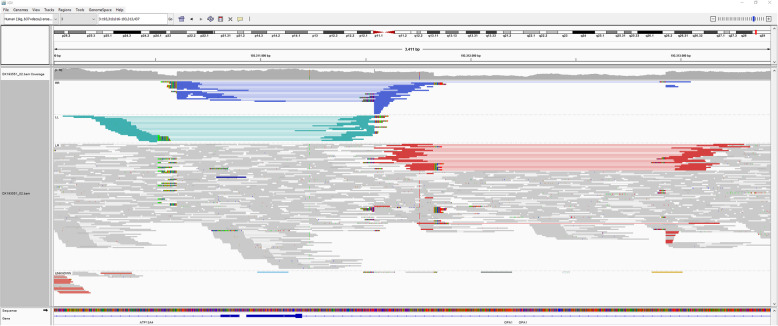 First submicroscopic inversion of the OPA1 gene identified in dominant optic atrophy - a case report.