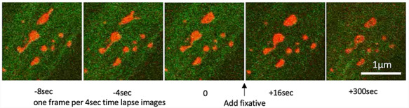 Correlation of organelle dynamics between light microscopic live imaging and electron microscopic 3D architecture using FIB-SEM