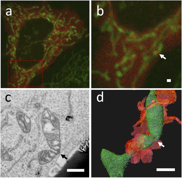 Correlation of organelle dynamics between light microscopic live imaging and electron microscopic 3D architecture using FIB-SEM