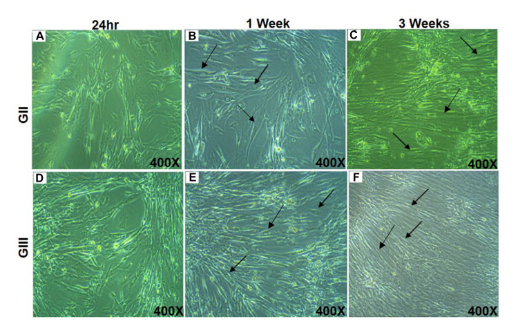 The Potentiality of Human Umbilical Cord Isolated Mesenchymal Stem/Stromal Cells for Cardiomyocyte Generation.