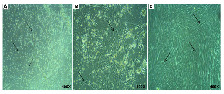 The Potentiality of Human Umbilical Cord Isolated Mesenchymal Stem/Stromal Cells for Cardiomyocyte Generation.