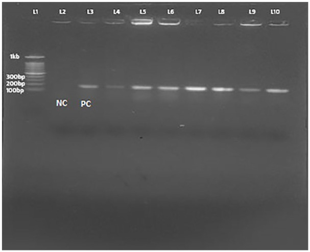 Characteristics of <i>Staphylococcus aureus</i> Isolated From Clinical Specimens in a Tertiary Care Hospital, Kathmandu, Nepal.