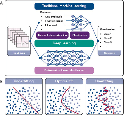 Big Data and Artificial Intelligence: Opportunities and Threats in Electrophysiology.