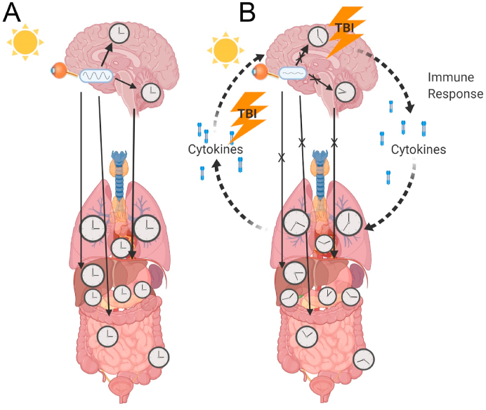 The interaction of the circadian and immune system: Desynchrony as a pathological outcome to traumatic brain injury