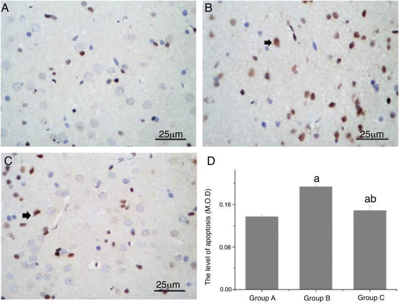 A ativação autofágica atenua a neurotoxicidade dos anestésicos locais ao diminuir a atividade da caspase‐3 em ratos