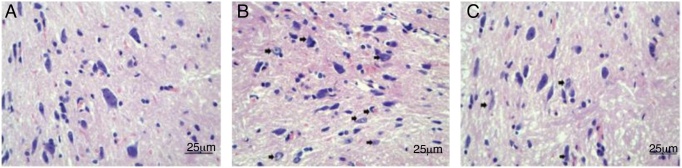 A ativação autofágica atenua a neurotoxicidade dos anestésicos locais ao diminuir a atividade da caspase‐3 em ratos