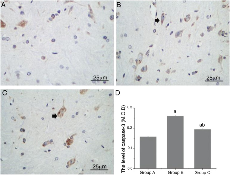 A ativação autofágica atenua a neurotoxicidade dos anestésicos locais ao diminuir a atividade da caspase‐3 em ratos