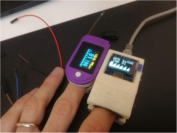 3D printing technology and internet of things prototyping in family practice: building pulse oximeters during COVID-19 pandemic.