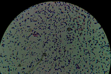 The First Case of L. pseudomesenteroides Pulmonary Infection and Literature Review.