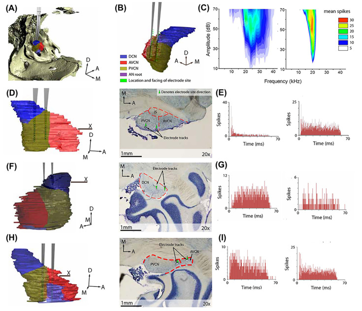 Auditory fear conditioning alters neural gain in the cochlear nucleus: a wireless neural recording study in freely behaving rats.