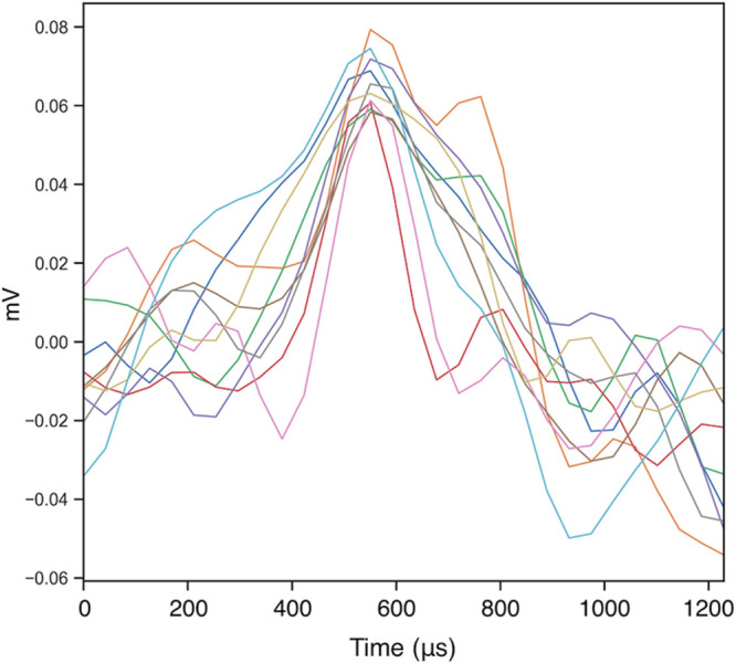 Auditory fear conditioning alters neural gain in the cochlear nucleus: a wireless neural recording study in freely behaving rats.