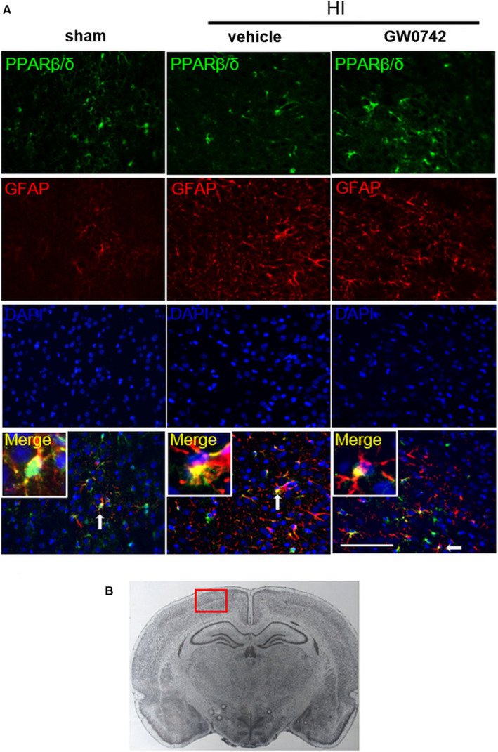 GW0742 activates miR-17-5p and inhibits TXNIP/NLRP3-mediated inflammation after hypoxic-ischaemic injury in rats and in PC12 cells.