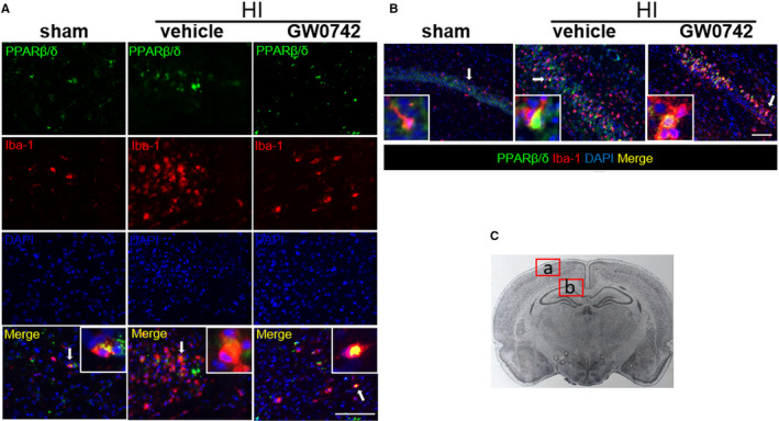 GW0742 activates miR-17-5p and inhibits TXNIP/NLRP3-mediated inflammation after hypoxic-ischaemic injury in rats and in PC12 cells.