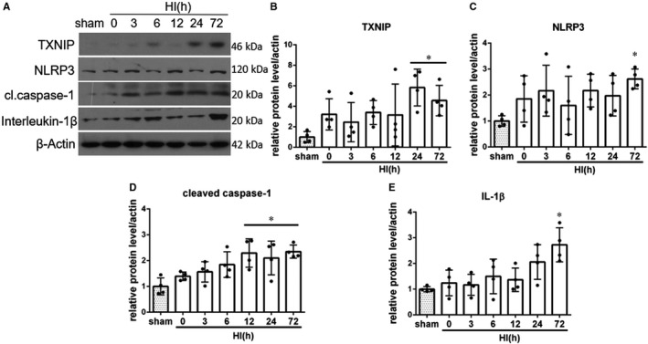 GW0742 activates miR-17-5p and inhibits TXNIP/NLRP3-mediated inflammation after hypoxic-ischaemic injury in rats and in PC12 cells.