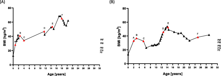 Diagnostic and therapeutic odyssey of two patients with compound heterozygous leptin receptor deficiency.