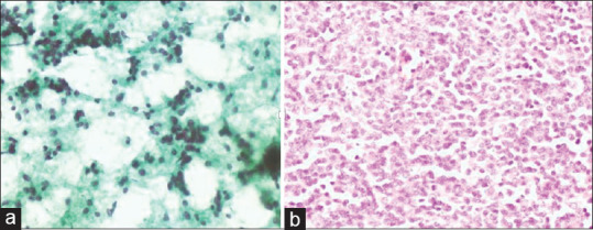 Diagnostic Accuracy of Fine-Needle Aspiration Cytology in Head and Neck Lesions from a Tertiary Health Facility in Southwestern Nigeria.