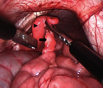 Laparoscopic Ovariectomy in a Domestic Yak.