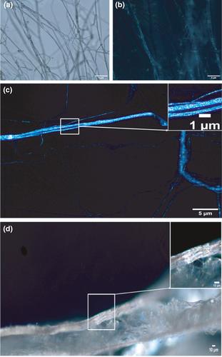 Next-generation Antimicrobial Peptides (AMPs) incorporated nanofibre wound dressings