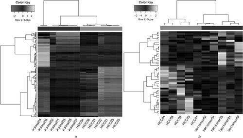 Identification and analysis of circRNA–miRNA–mRNA regulatory network in hepatocellular carcinoma