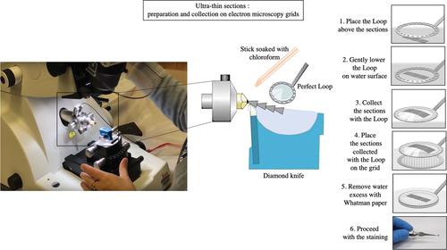 Using Human Primary Foreskin Fibroblasts to Study Cellular Damage and Mitochondrial Dysfunction