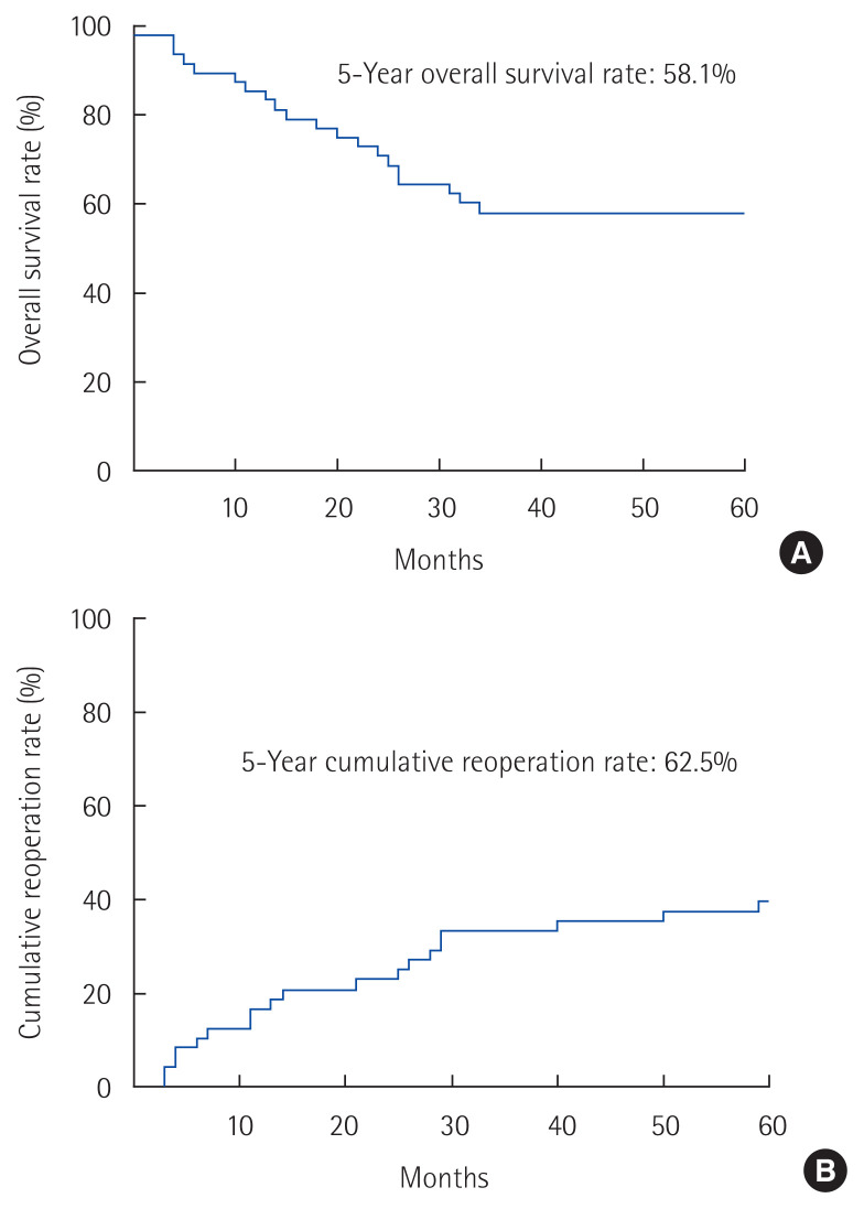 Retroperitoneal sarcomas: Outcomes of repeated resections.