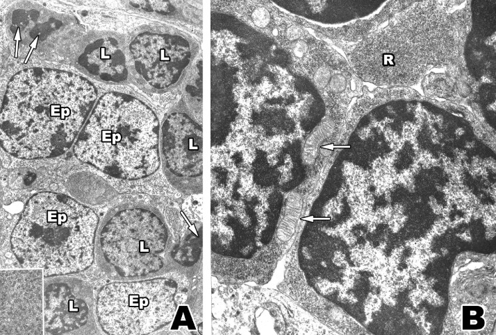 Ultrastructural study of the thymus of Mugil liza Valenciennes, 1836 juveniles