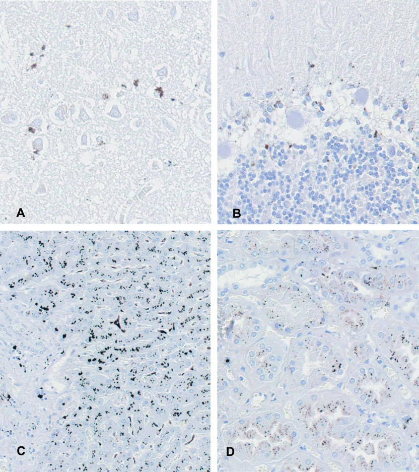 Mercury and Selenium Localization in the Cerebrum, Cerebellum, Liver, and Kidney of a Minamata Disease Case.