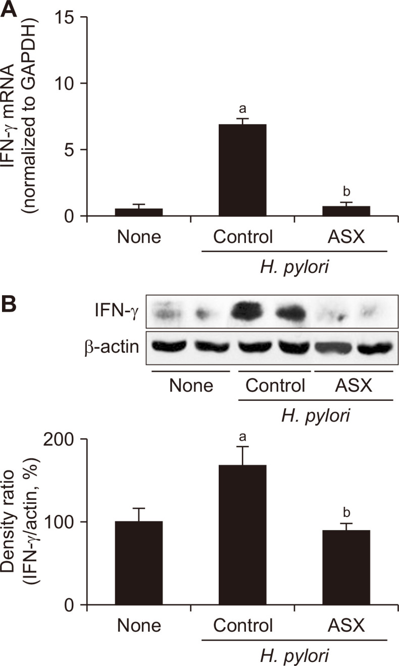 Astaxanthin Inhibits <i>Helicobacter pylori</i>-induced Inflammatory and Oncogenic Responses in Gastric Mucosal Tissues of Mice.