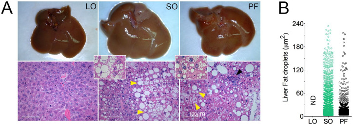 Dietary Fat Quality in Normolipidic Diets Affects Hepatocyte's Nuclear Phenotypes.