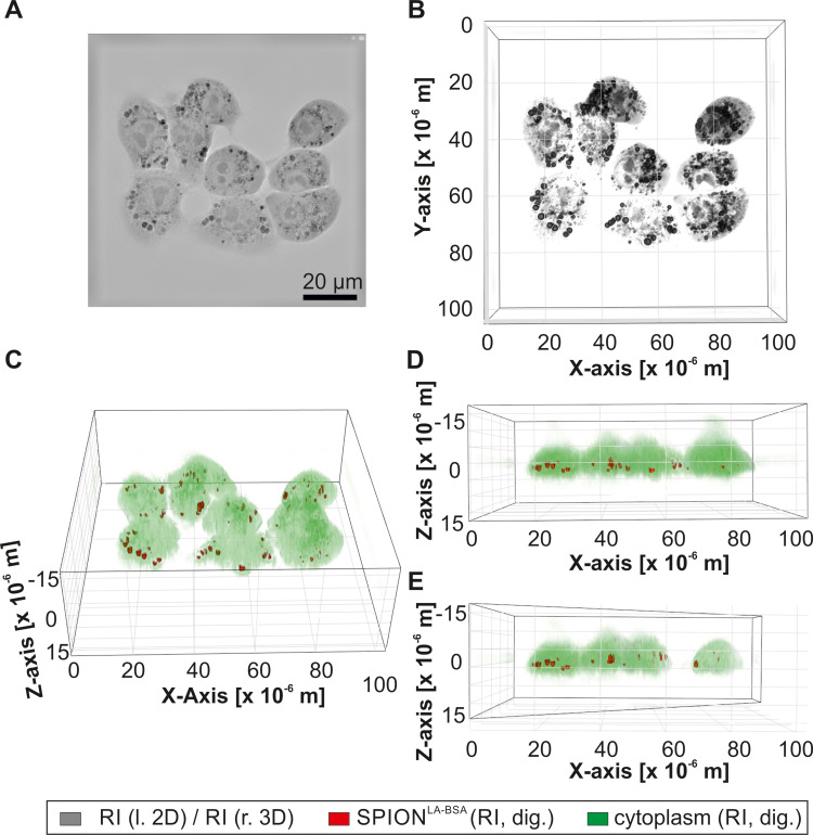 Intracellular Quantification and Localization of Label-Free Iron Oxide Nanoparticles by Holotomographic Microscopy.