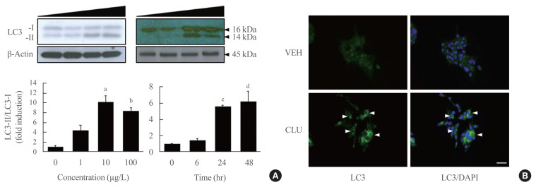 Clusterin Protects Lipotoxicity-Induced Apoptosis via Upregulation of Autophagy in Insulin-Secreting Cells.