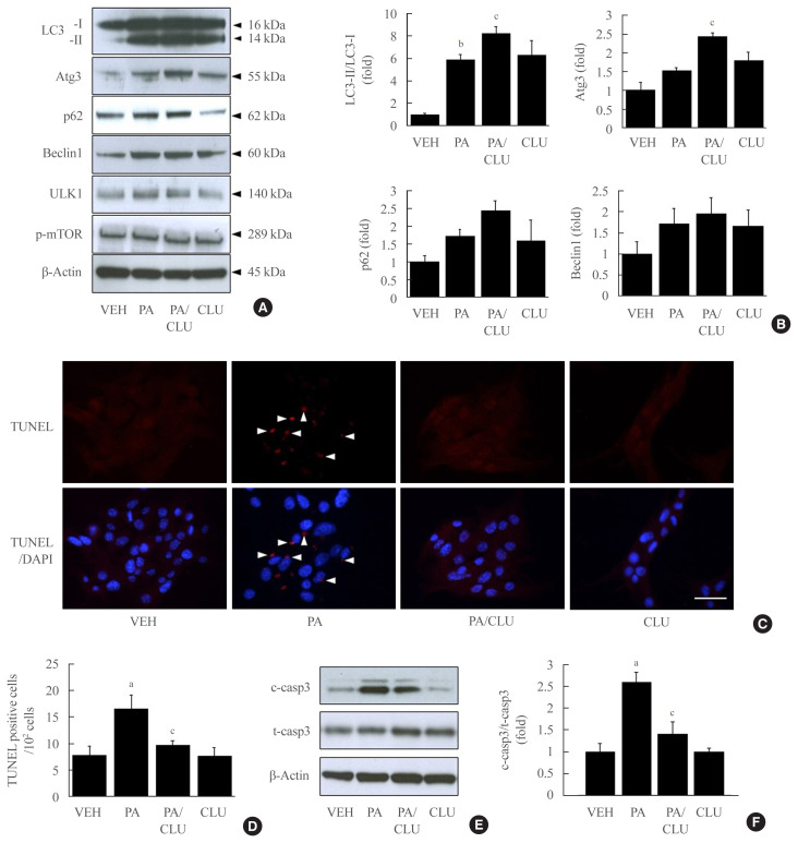 Clusterin Protects Lipotoxicity-Induced Apoptosis via Upregulation of Autophagy in Insulin-Secreting Cells.