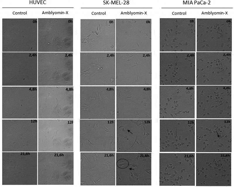 Amblyomin-X, a recombinant Kunitz-type inhibitor, regulates cell adhesion and migration of human tumor cells.