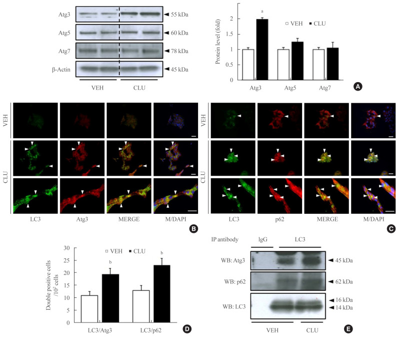 Clusterin Protects Lipotoxicity-Induced Apoptosis via Upregulation of Autophagy in Insulin-Secreting Cells.