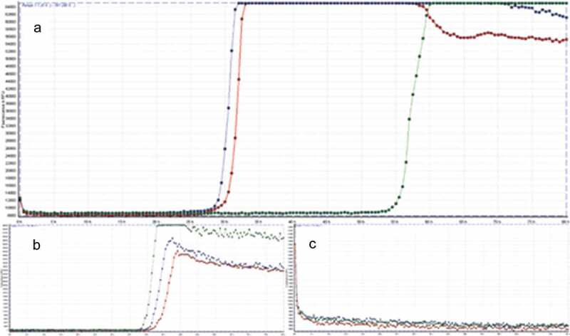 An enigmatic case of cortical anopsia: Antemortem diagnosis of a 14-3-3 negative Heidenhain-variant MM1-sCJD.