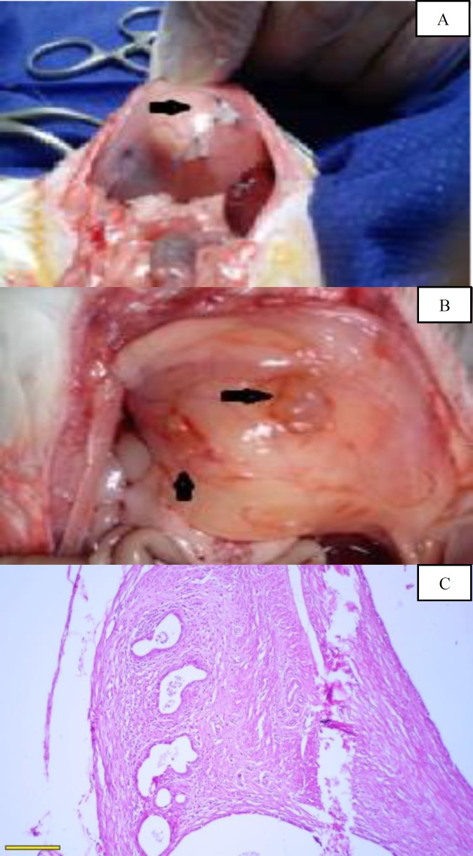 Assessing Pain Behavioral Responses and Neurotrophic Factors in the Dorsal Root Ganglion, Serum and Peritoneal Fluid in Rat Models of Endometriosis.