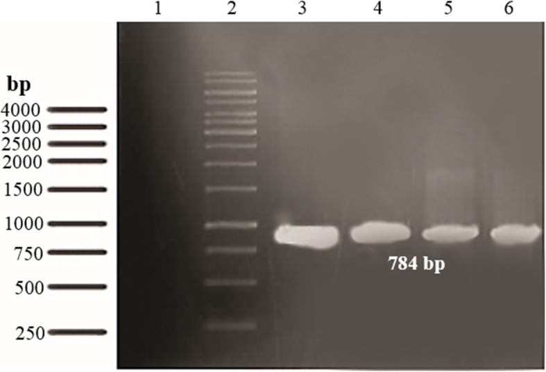 Mutational Analysis of Ocriplasmin to Reduce Proteolytic and Autolytic Activity in Pichia pastoris.