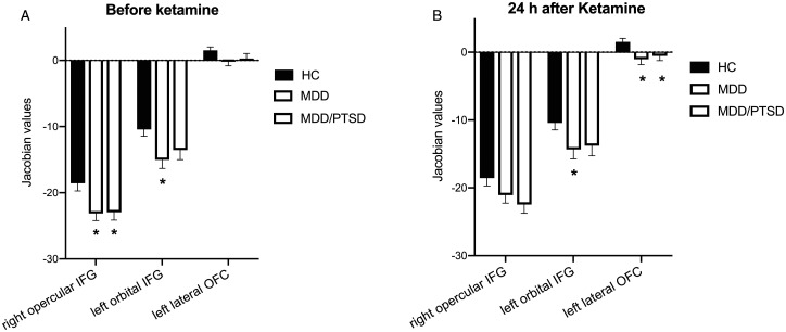 Ketamine Normalizes the Structural Alterations of Inferior Frontal Gyrus in Depression.