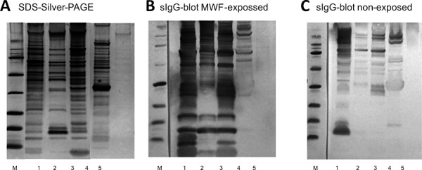 Microbial contamination in water-based metalworking fluid as trigger for occupational hypersensitivity pneumonitis - development of specific IgG tools for a suspected clinical case.