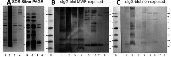 Microbial contamination in water-based metalworking fluid as trigger for occupational hypersensitivity pneumonitis - development of specific IgG tools for a suspected clinical case.