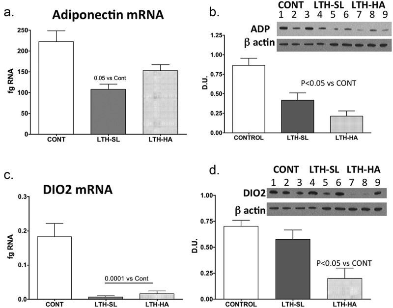 Long term hypoxia during gestation alters perirenal adipose tissue gene expression in the lamb.