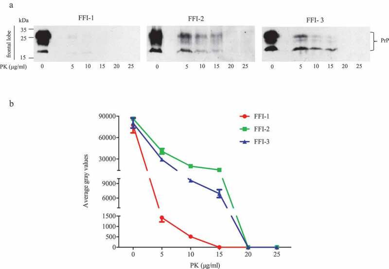 Different post-mortem brain regions from three Chinese FFI patients induce different reactive profiles both in the first and second generation RT-QuIC assays.