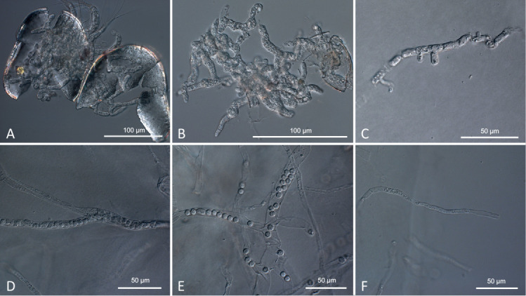 <i>Bolbea parasitica</i> <i>gen. et sp. nov</i>., a cultivable holocarpic parasitoid of the early-diverging <i>Saprolegniomycetes</i>.