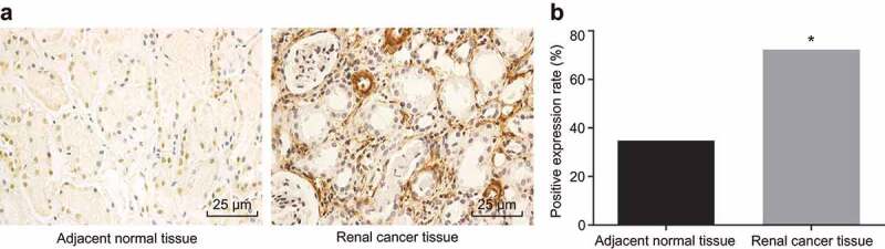 MicroRNA-203 inhibits epithelial-mesenchymal transition, migration, and invasion of renal cell carcinoma cells via the inactivation of the PI3K/AKT signaling pathway by inhibiting CAV1.