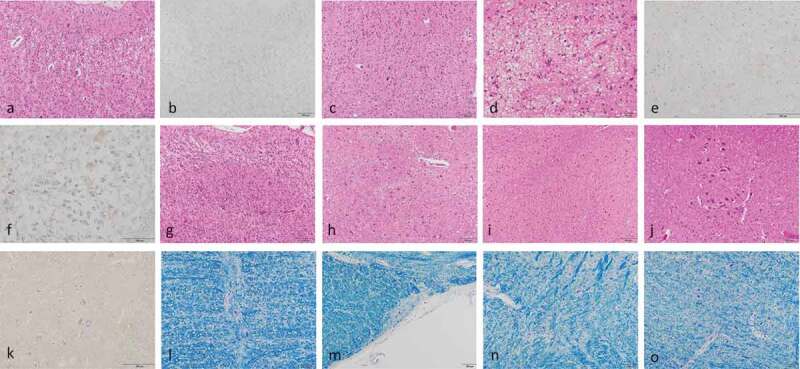 Clinicopathological findings of a long-term survivor of V180I genetic Creutzfeldt-Jakob disease.